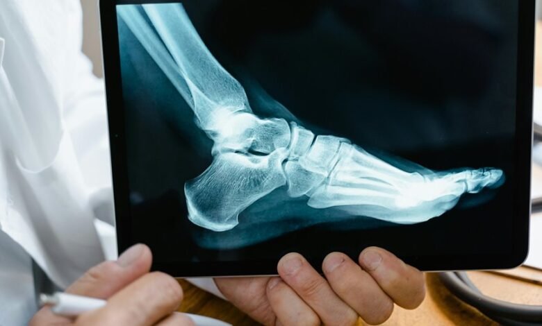 weekend missed call analysis